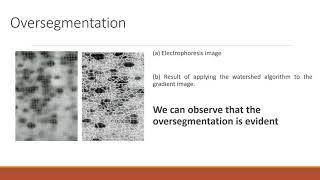 Usage of Markers in Segmentation by morphological watersheds [upl. by Ode498]