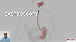 Gastroscopy [upl. by Anaic]