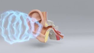 Explore the Science of Hearing Loss  MiracleEar Hearing Center [upl. by Attaymik876]