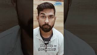 Bells Palsy Treatment with Innovative Exercises at Dehradun India bellspalsy [upl. by Milas661]