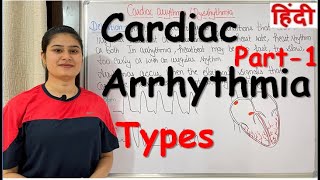 Cardiac Arrhythmia  Part1  Types of Cardiac Arrhythmia  RajNEET Medical Education [upl. by Ailsun]