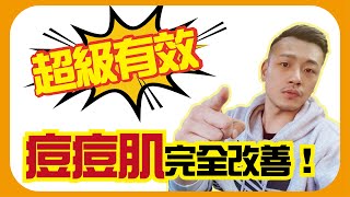 對抗青春痘大作戰 ！還我漂漂拳 ！！【77老大】 [upl. by Cristoforo]