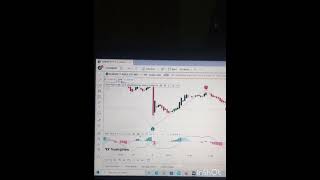 best strategy for option trading in tradingview  best strategy for options trading trading trader [upl. by Sajovich]