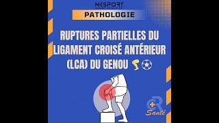 Rupture Partielle du LCA  Comprendre Diagnostiquer et Traiter LCA Kinésithérapie [upl. by Etsirk]