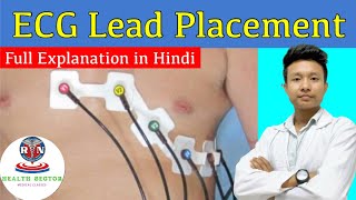 ECG Report Kaise dekhe  how to read ECG report  ECG reading in Hindi [upl. by Aleacin]