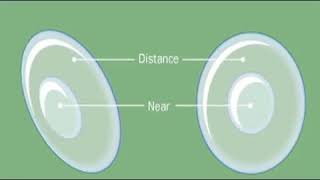 How Do Bifocal Soft Contact Lenses Work [upl. by Egwin]