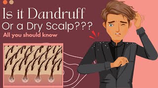 Is It Dandruff Or A Dry Scalp Heres What You Need To Know [upl. by Magna932]