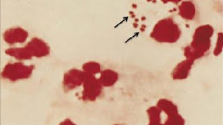 Medical Index  Aerobic Gram Neg Diplococci and Coccobacilli [upl. by Nyrrat95]