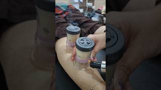 Moxibustion cupping for calfpainkneepainbackpainsciaticahipshoulderpain and blood circulation [upl. by Armelda5]