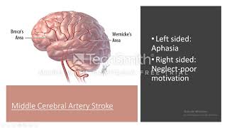 Syphilis meningovascular syphilis and Tabes dorsalis [upl. by Elyrrad]