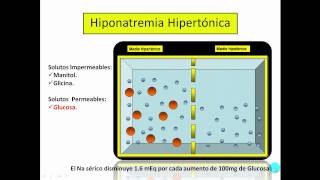 Hiponatremia Parte No1mp4 [upl. by Octavian]