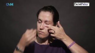 Facial Palsy DVD 1  Management of Flaccid Paralysis  Eye Taping [upl. by Benyamin384]