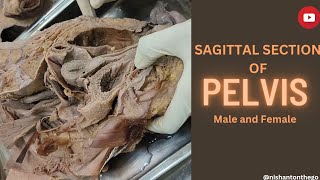 Sagittal section of Pelvis Dissection Anatomy [upl. by Anierdna]