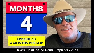 ClearChoice Dental Implants 2023  quot4 Months  Post Opquot E13 [upl. by Nasas95]