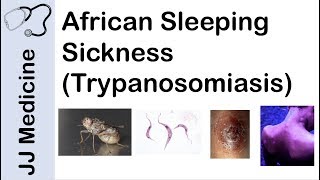 African Sleeping Sickness Trypanosomiasis  Causes Symptoms and Treatment [upl. by Ettenav972]