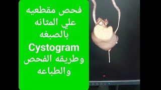 فحص Cystogram او اشعة بالصبغة علي المثانة علي جهاز مقطعيه GE [upl. by Syned]