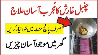 Chambal Ka Shafi ilaj  Easy Home Remedies for Psoriasis  چنبل کو آسان مجرب علاج  Happy Life [upl. by Collis]