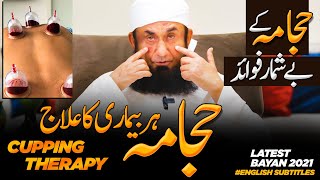 Cupping  Cure To Every Disease  Benefits of Cupping Therapy  Molana Tariq Jamil 3 March 2021 [upl. by Skell991]