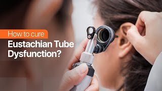 How to cure Eustachian Tube Dysfunction [upl. by Ehlke]