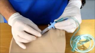 Needle Cricothyroidotomy [upl. by Lihas]