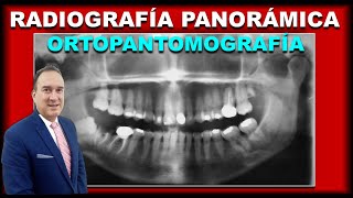 RADIOGRAFIAS PANORAMICAS DENTALES INTERPRETACION EN ORTODONCIA [upl. by Nolaj]