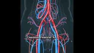 Cateterismo para Arteriografia Cerebral [upl. by Enirbas970]