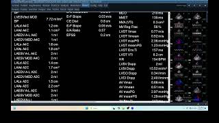 IQ 267 HEMODYNAMIC MEASUREMENT ECHOPAC ANALYSIS ECHOCARDIOGRAPHY REPORT [upl. by Ursuline]