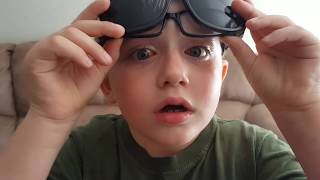 Strabismus Eye Surgery  6 Year Old Both Eyes [upl. by Daht]