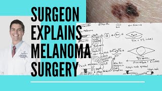 Surgeon explains melanoma surgery [upl. by Enywtna]