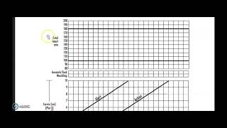 How to Open a Partograph [upl. by Eylhsa]