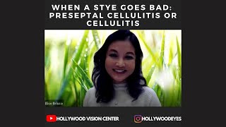 When a Stye Goes Bad Preseptal Cellulitis or Cellulitis [upl. by Ellynn]