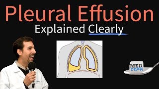 Pleural Effusion Explained Clearly  Causes Pathophysiology Symptoms Treatment [upl. by Aleda]