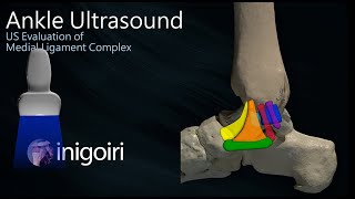 ANKLE ULTRASOUND MEDIAL LIGAMENT COMPLEX EVALUATION [upl. by Notxam124]