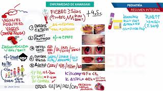 Pediatría  Exantemas Kawasaki [upl. by Trenton59]