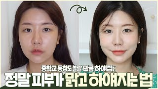 SUB 중학교 동창도 놀랄 만큼 하얘진 얼굴✨ 보통피부에서 흰 피부 된 비결❗️ 이것들만 기억하면 무조건 하얘진다🧐 효과 본 찐 꿀템들까지 싹 풉니다 학생 특히 꼭 봐❗️ [upl. by Giule580]