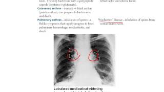 5 Microbiology CLINICAL Bacteriology Part 2 [upl. by Petronella]