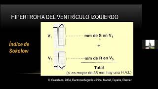 04 CRECIMIENTO DE CAVIDADES VENTRICULARES [upl. by Syramad]