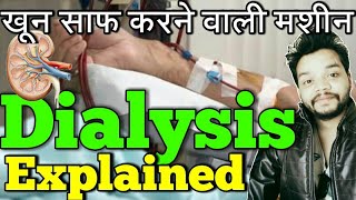 Dialysis in Hindi  How To filter blood without kidney [upl. by Susy]