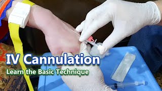 IV Cannulation  Learn the Basic Technique  IV Cannula [upl. by Pollyanna522]