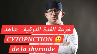 شاهد بالتفصيل خزعة الغدة الدرقية cytopontion de la thyroïde [upl. by Joelynn]