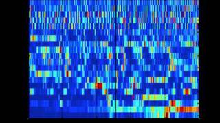 SCHIZOPHRENIA AS SOUND listening to the dynamic brain [upl. by Airebma]