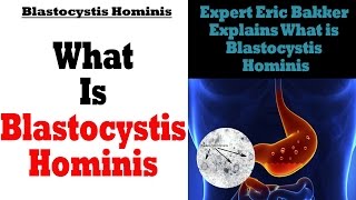 What Is Blastocystis Hominis  Ask Eric Bakker [upl. by Refannej326]