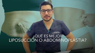 Liposucción vs Abdominonoplastia Lipoescultura o Lipectomia ¿Cuál es mejor [upl. by Aleetha]