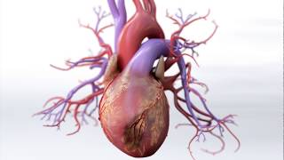 What is Coronary Artery Disease  Mechanism of Disease [upl. by Maxfield]