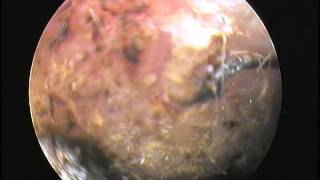 DES MOINES VETERINARY CARE VIDEO  Ear Mites Viewed with Video Otoscope at Ingersoll Animal Hospital [upl. by Dnalkrik]