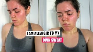 I AM ALLERGIC TO MY OWN SWEATALLAINAMADELEINE [upl. by Lina]