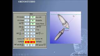 Il calcolo delloverjet Metodo Ortostudio [upl. by Enomis]