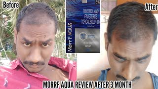 Morr F Minoxidil with Redensyl amp Procapil review after 3 months of use finasteride minoxidil dht [upl. by Iht]