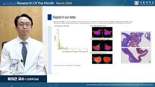 SNU MEDICINE 이달의 연구 2024년 3월 내과학교실 최의근 교수님클론성 조혈증과 심방세동동아시아 코호트 연구 [upl. by Bautram]