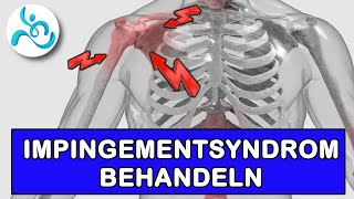 Schmerzen in der Schulter behandeln  SchulterImpingement Teil 6 [upl. by Lief]